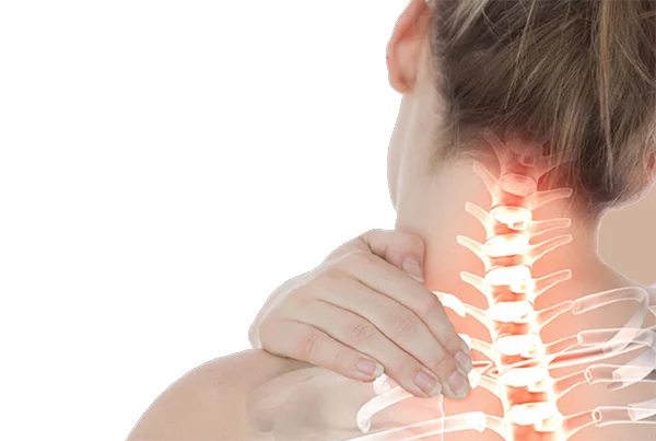 Spondylosis